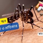 ডেঙ্গু রোগের লক্ষণ ও প্রতিকার