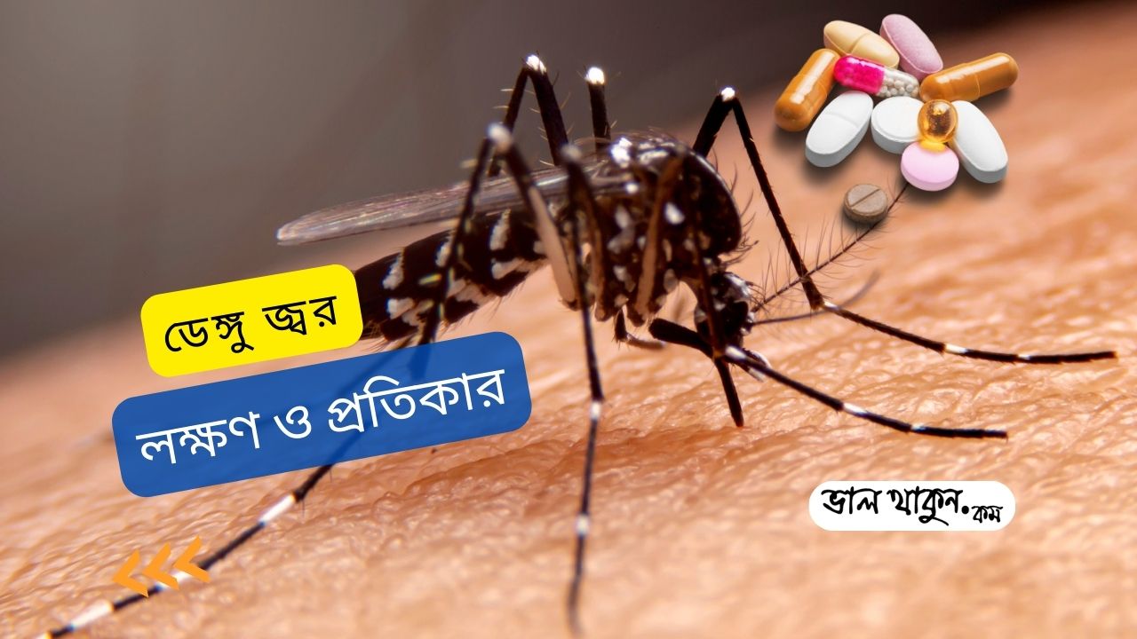 ডেঙ্গু রোগের লক্ষণ ও প্রতিকার