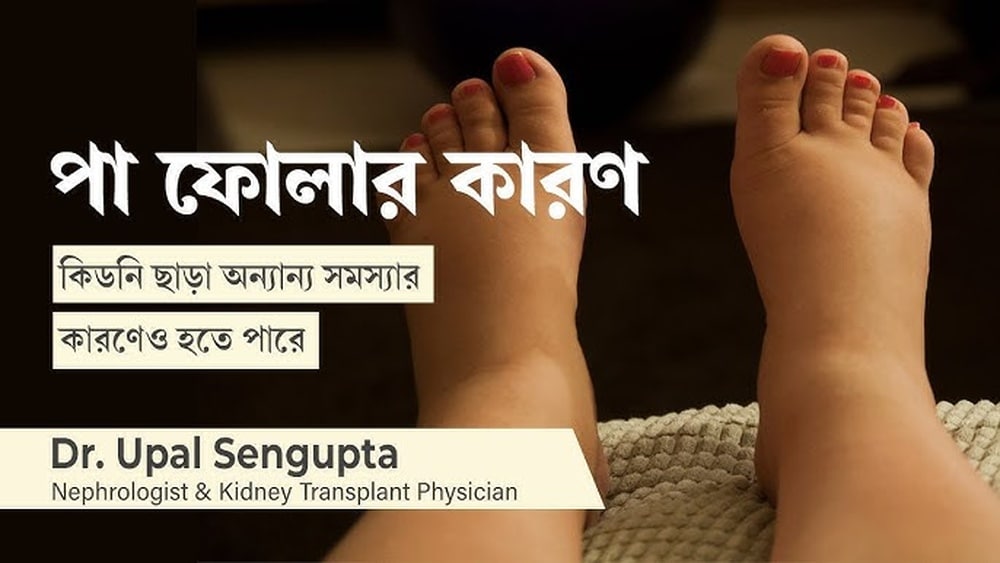 গর্ভাবস্থায় পা ও আঙুল ফুলে গেলে করণীয় (Pregnancy Swollen Feet)