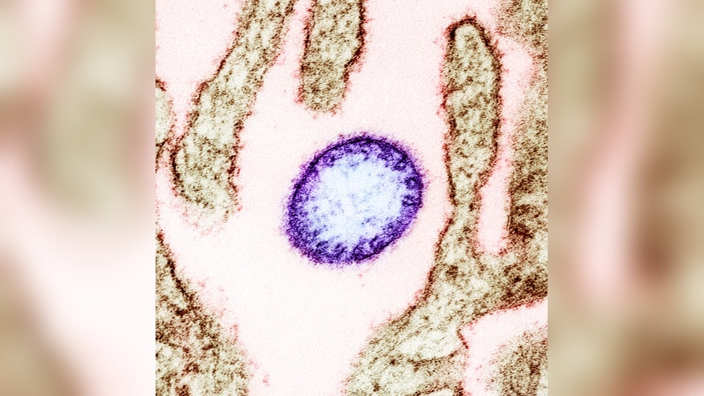 বাংলাদেশে নিপাহ ভাইরাস (Nipah Virus in Bangladesh)